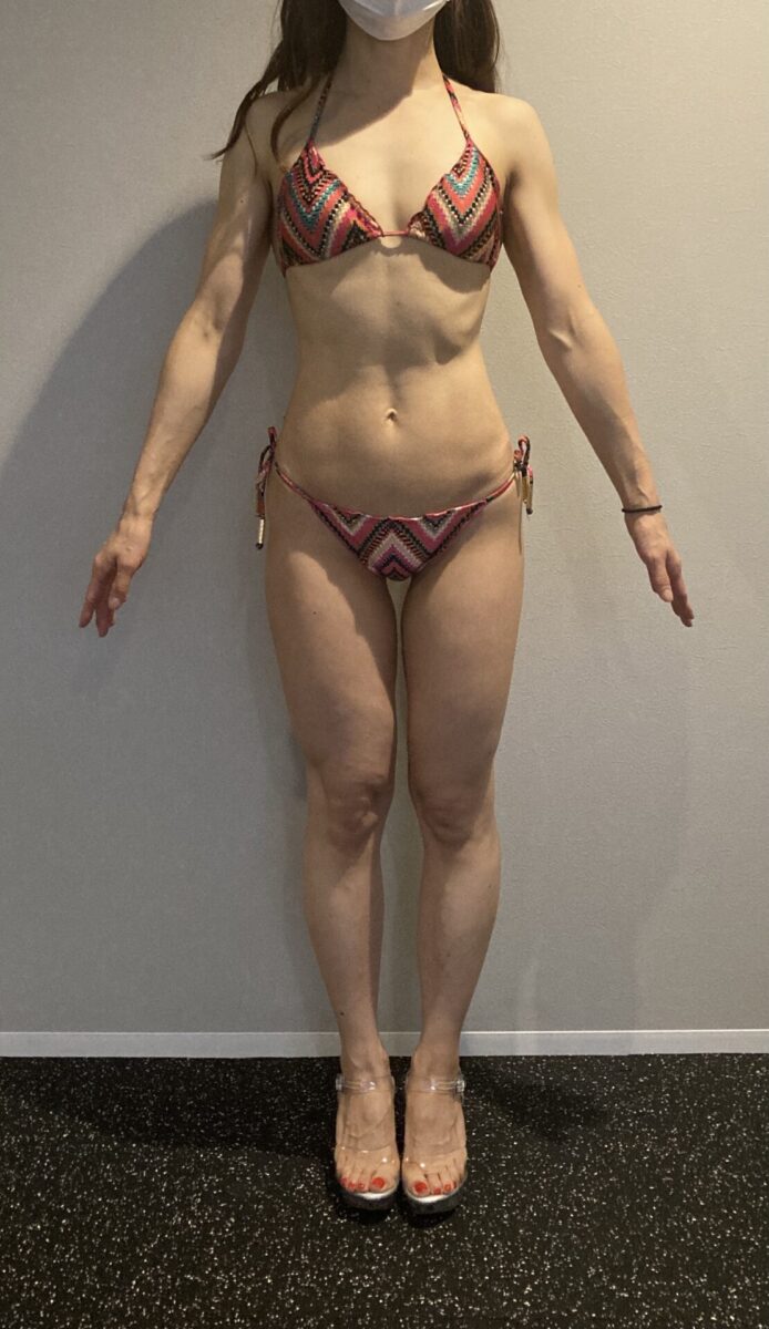 40代女性　before / afterお写真