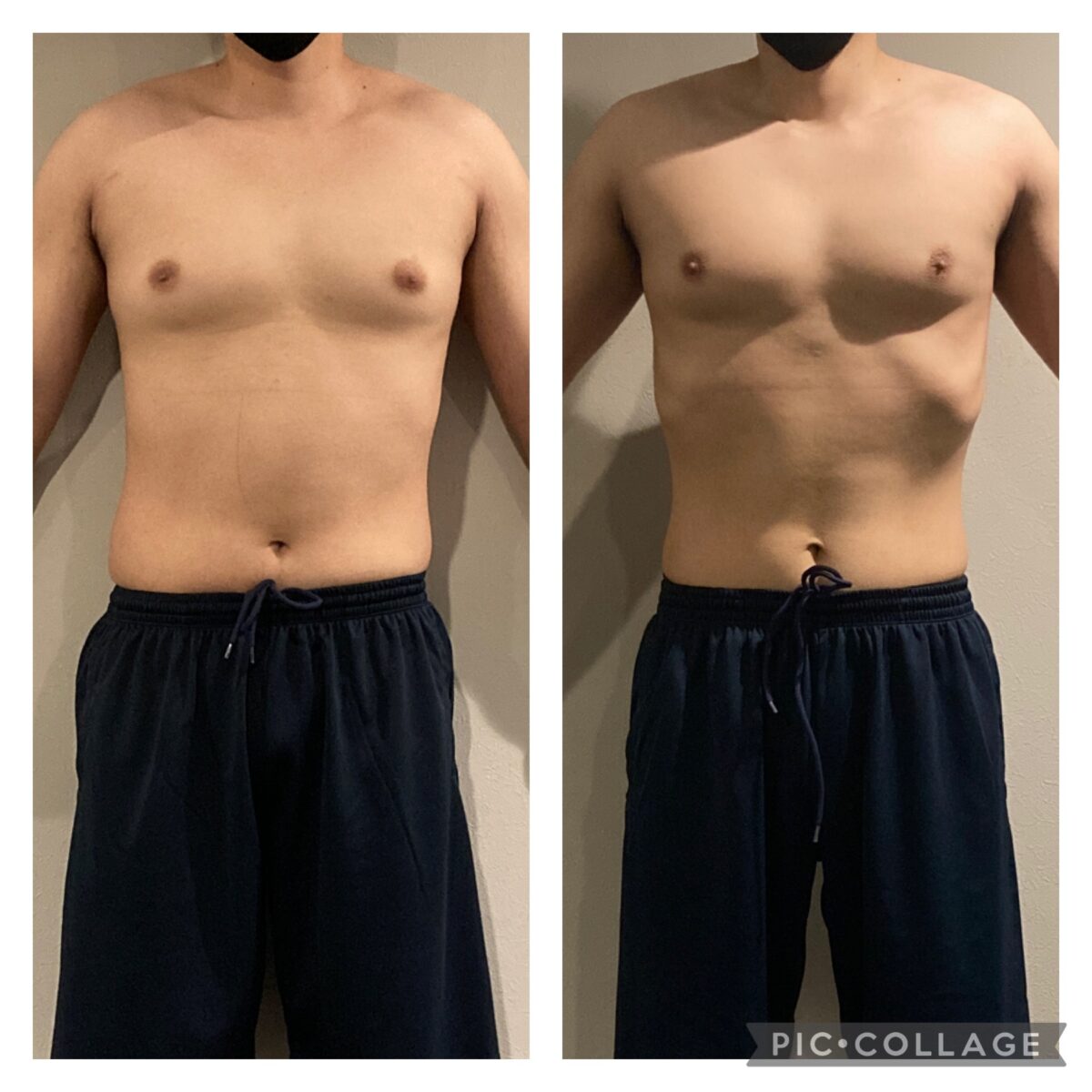 20代男性　before /afterお写真