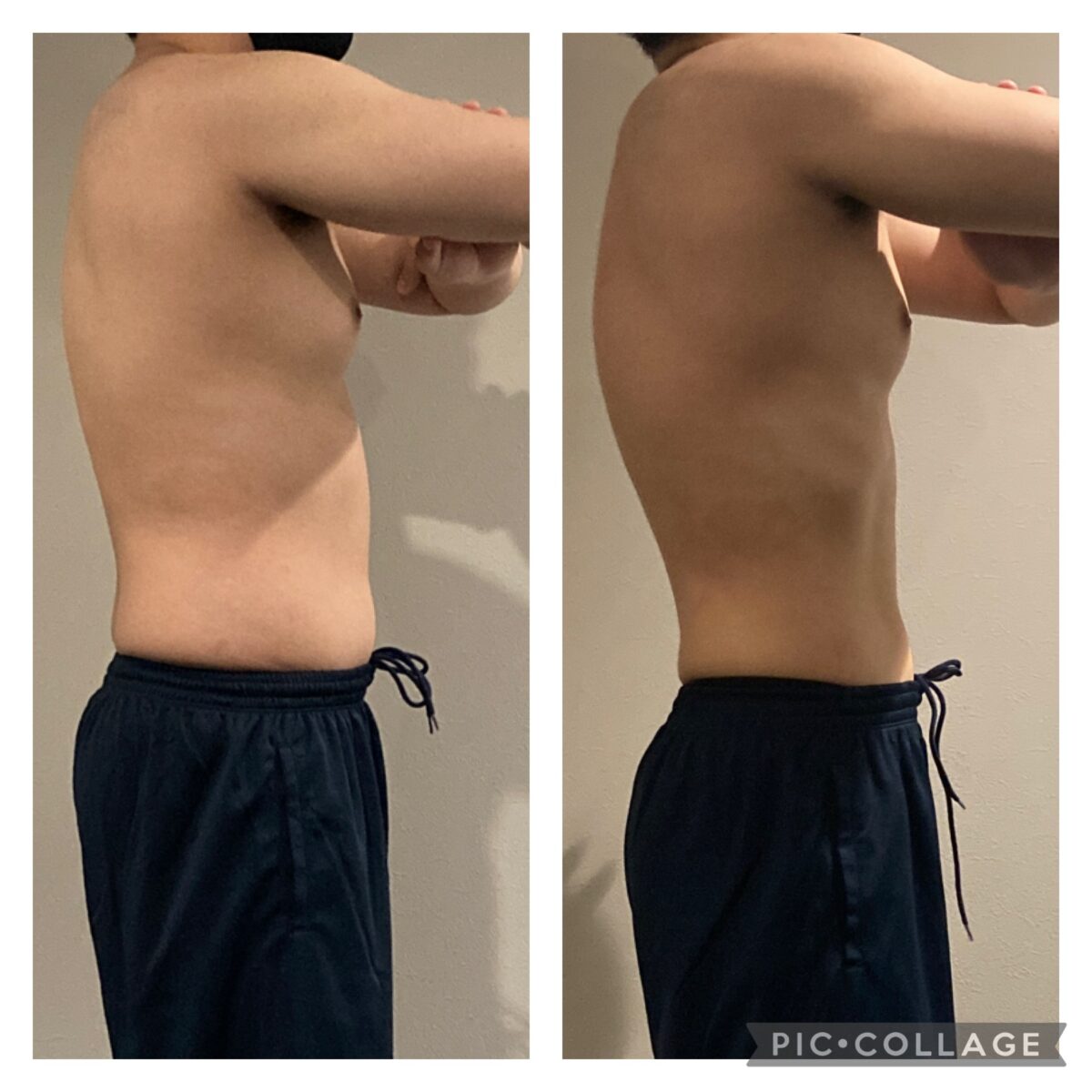 20代男性　before /afterお写真