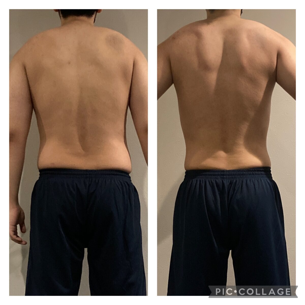 20代男性　before /afterお写真