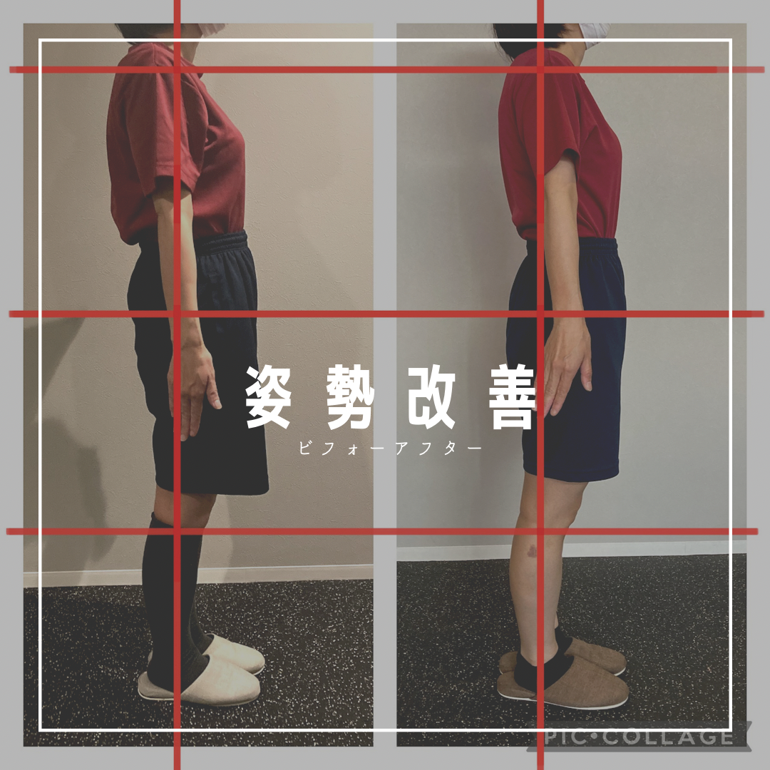 New!!【姿勢改善ビフォーアフター①】大曽根パーソナルトレーニング　「FOR ME GYM」フォーミージム」