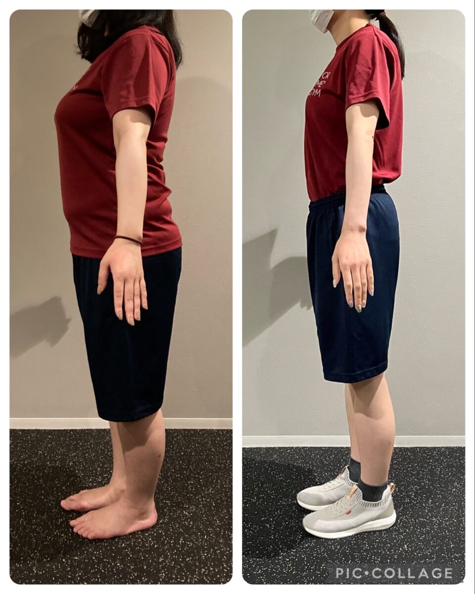 30代　女性ビフォーアフター