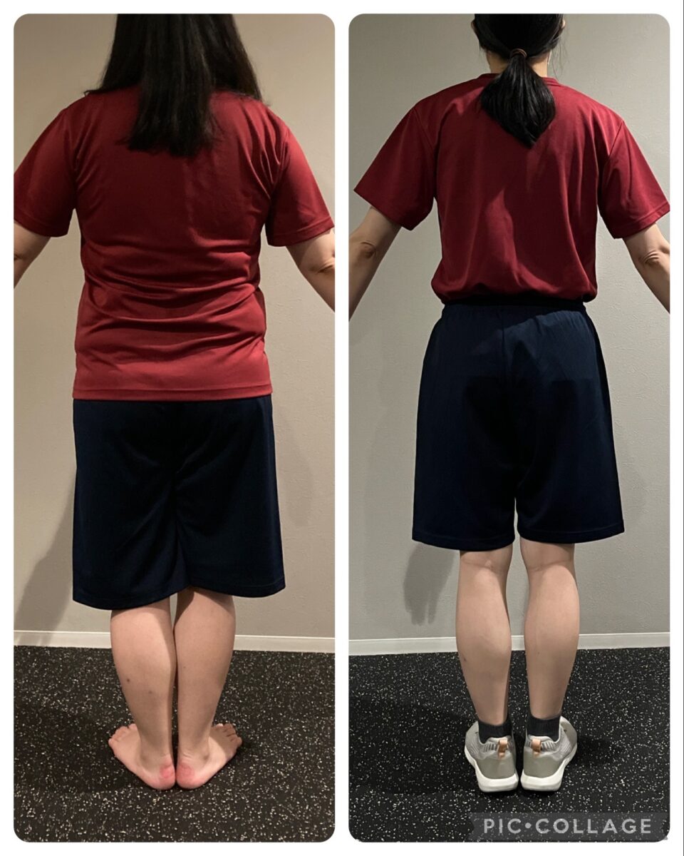 30代　女性ビフォーアフター