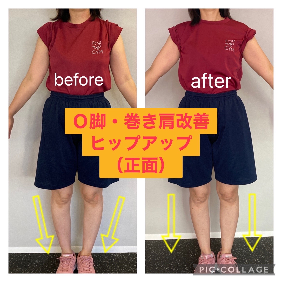 50代　女性ビフォーアフター〈美脚プログラム〉