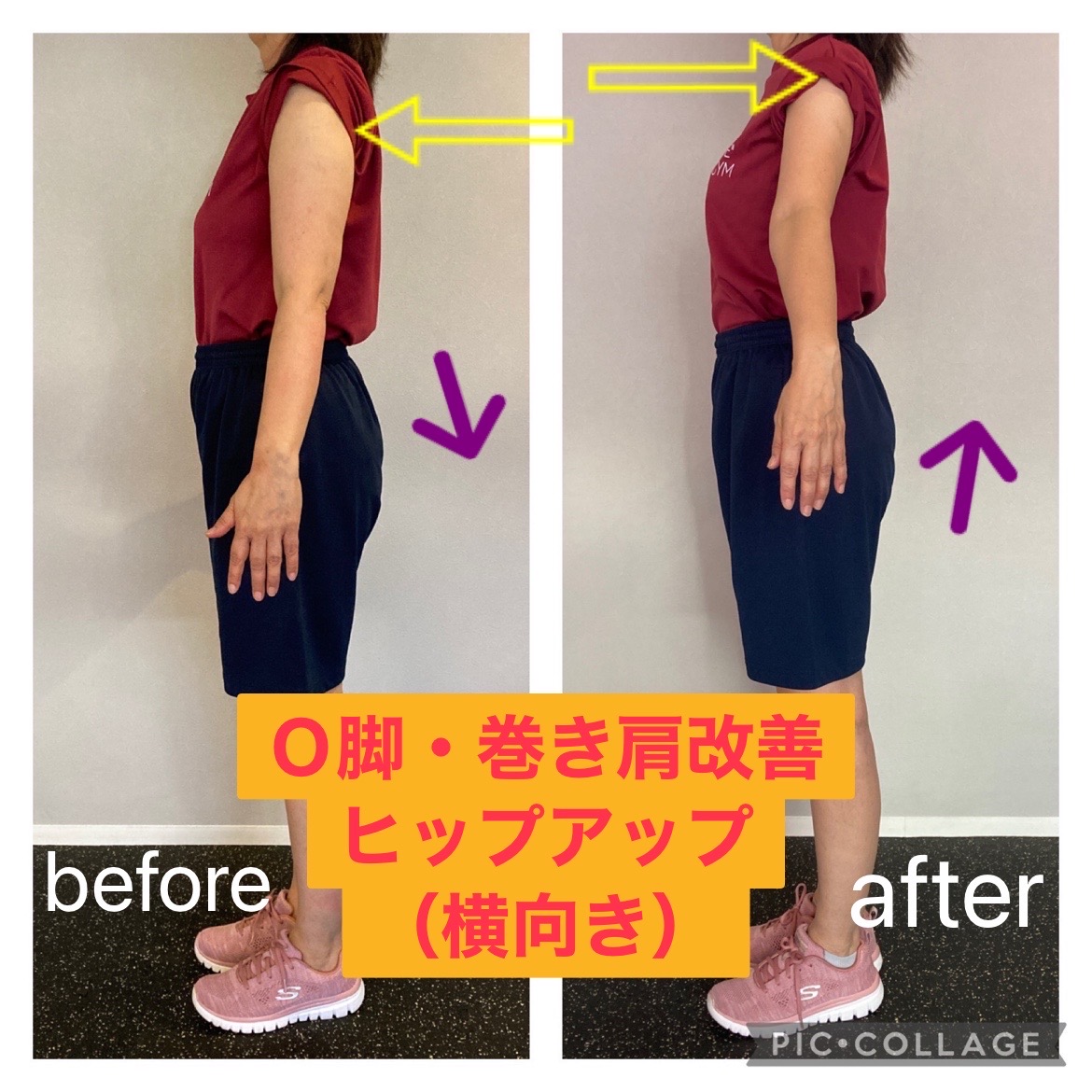 50代　女性ビフォーアフター〈美脚プログラム〉