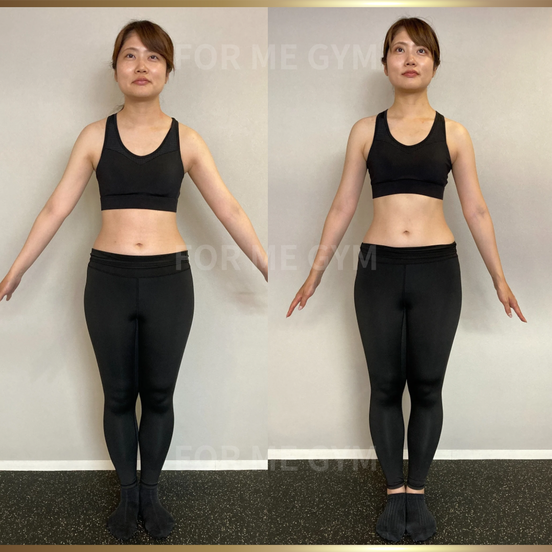 32歳 女性 ビフォーアフター〈食事制限なしで姿勢改善!〉