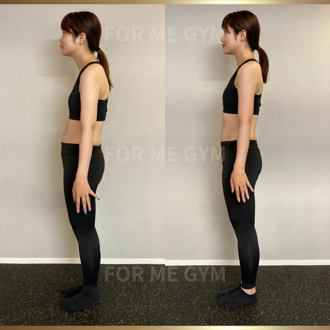 32歳 女性 ビフォーアフター〈食事制限なしで姿勢改善！〉