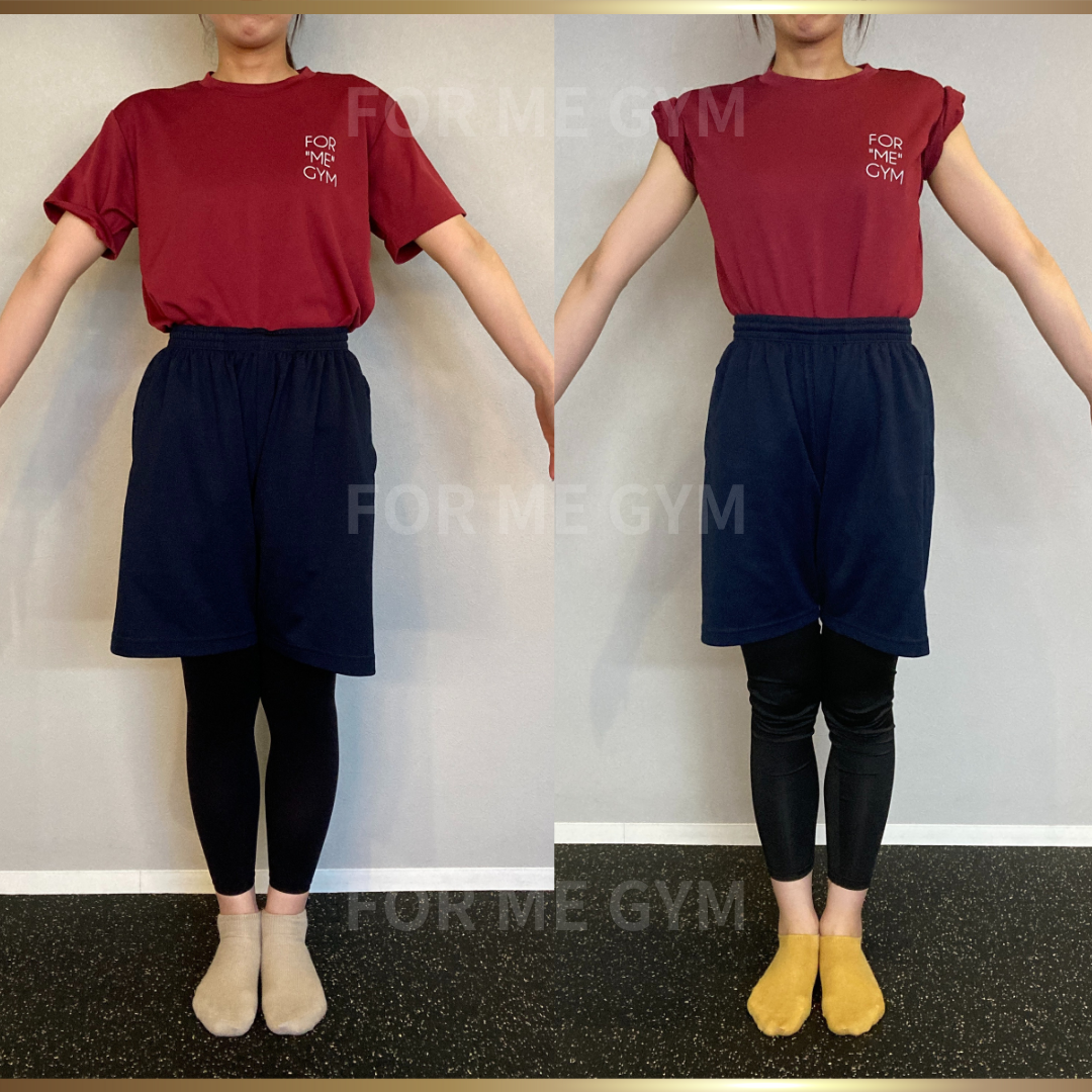 27歳 女性ビフォーアフター〈フォトウエディングに向けてボディメイク！〉