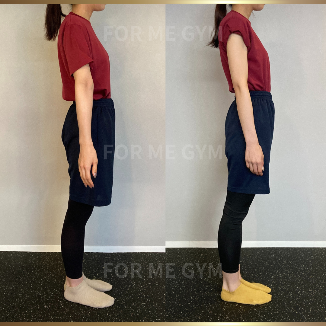 27歳 女性ビフォーアフター〈フォトウエディングに向けてボディメイク！〉