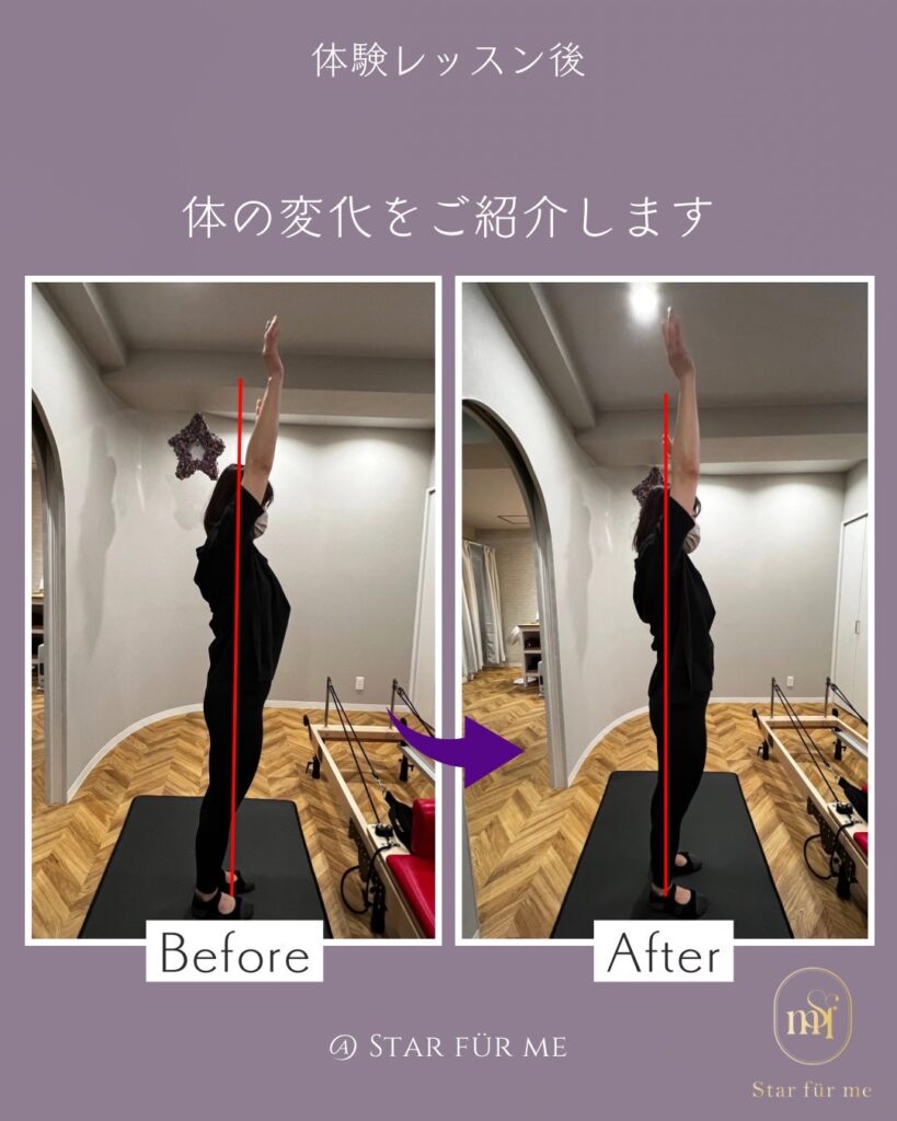 レッスンの前と後に両腕を上へ挙げた姿勢を並べた比較写真。腕の上がり方を赤い縦線で見ている